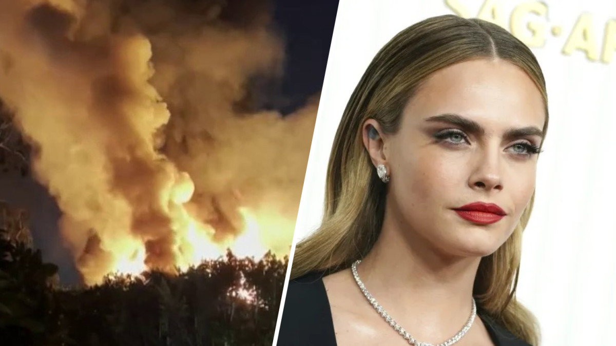 Actor Cara Delevingne’s Studio City home burns in fire – NBC Los Angeles