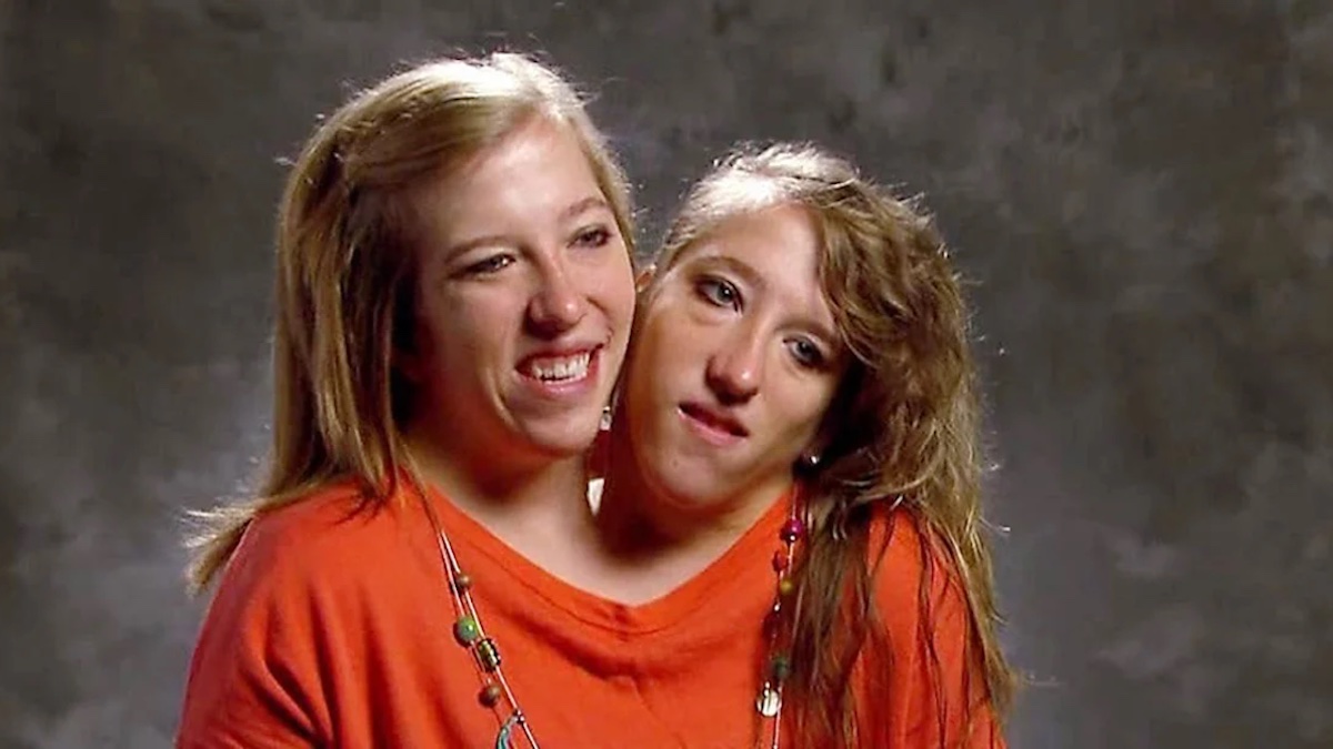 Conjoined twins Brittany and Abby Hensel respond to ‘loud’ comments after Josh Bowling wedding reveal – NBC Connecticut