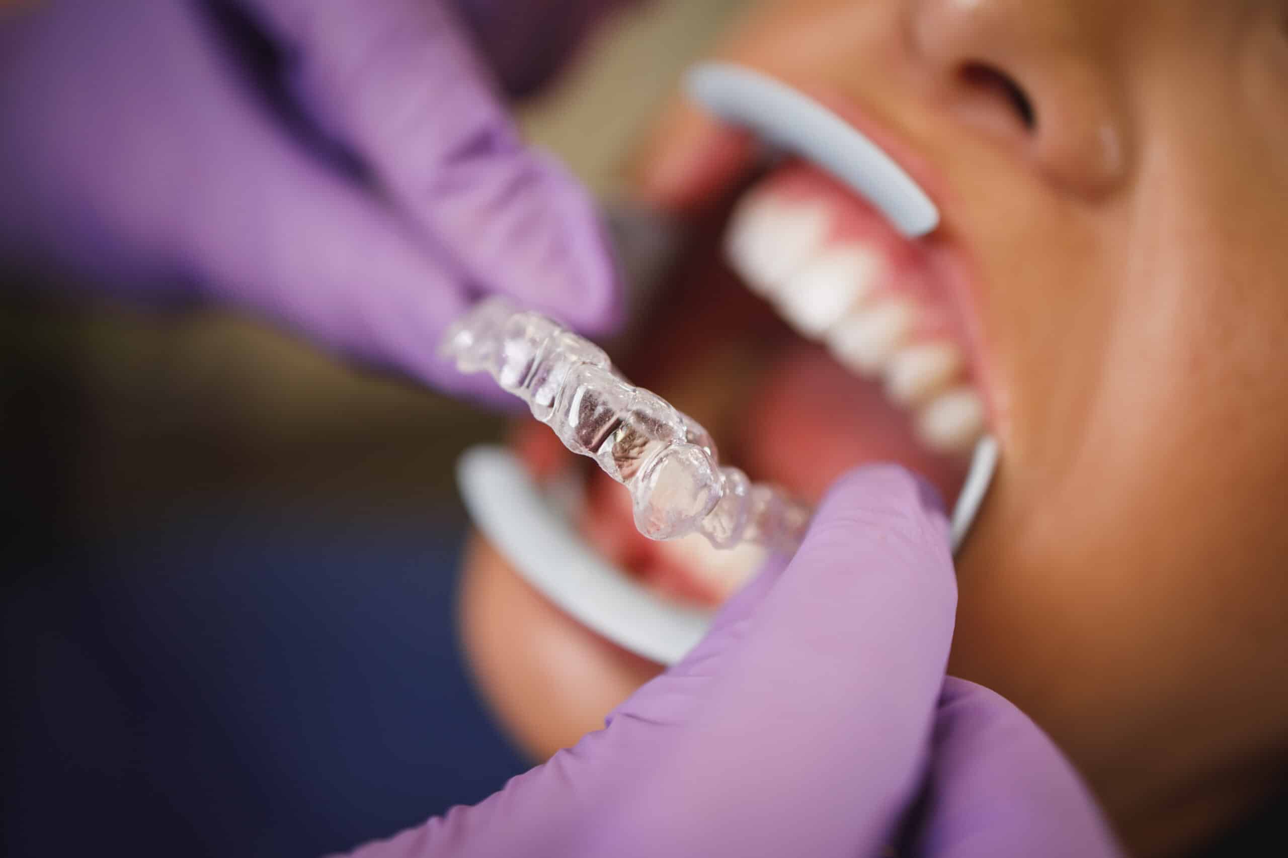 Finding the Best Orthodontist in Boise, Idaho