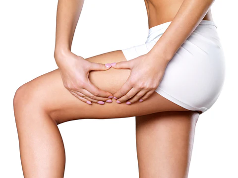 Home Remedies for Cellulite Removal