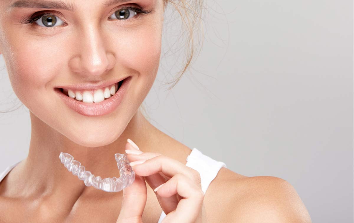 clear aligners