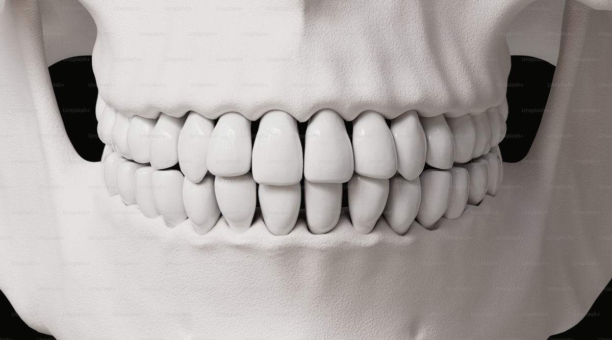 Why Should You Choose Invisalign Over Traditional Braces?