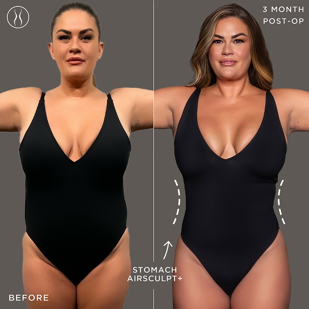 See Brittany Cartwrights Before and After AirSculpt Photos I Deserve to Feel Good