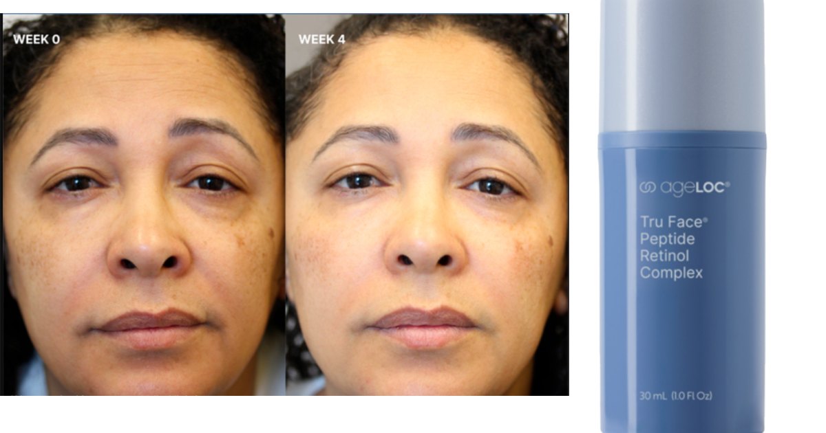 This Skin Complex From Nu Skin Can Help Reduce Wrinkles