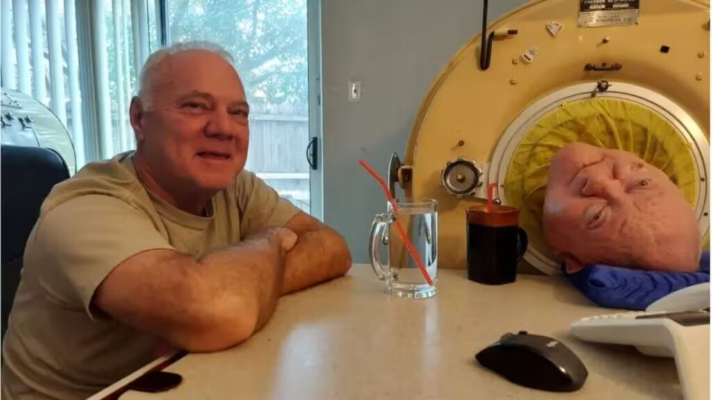 A six-year-old entered an iron lung after polio. More than 70 years later, he had become the world’s longest-known survivor | World News