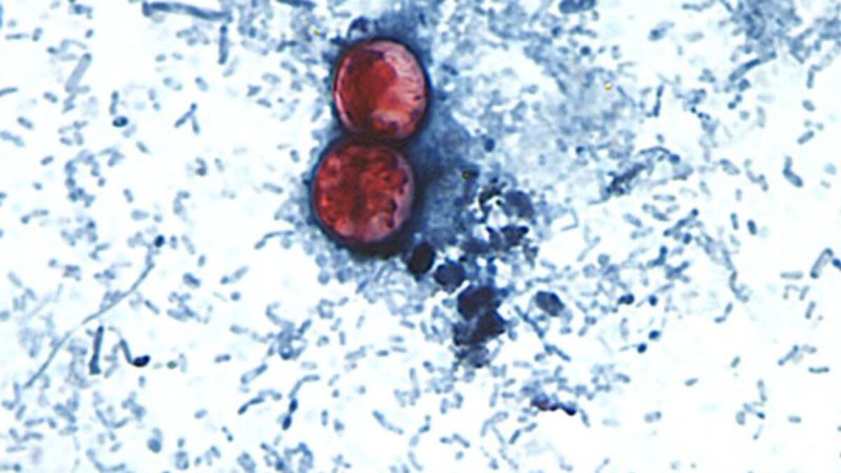 Diarrhea-causing parasite that can contaminate raw produce causing misery across several states — MARKET — Aslikannih