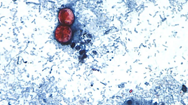Massive cyclosporiasis outbreak linked to four more states