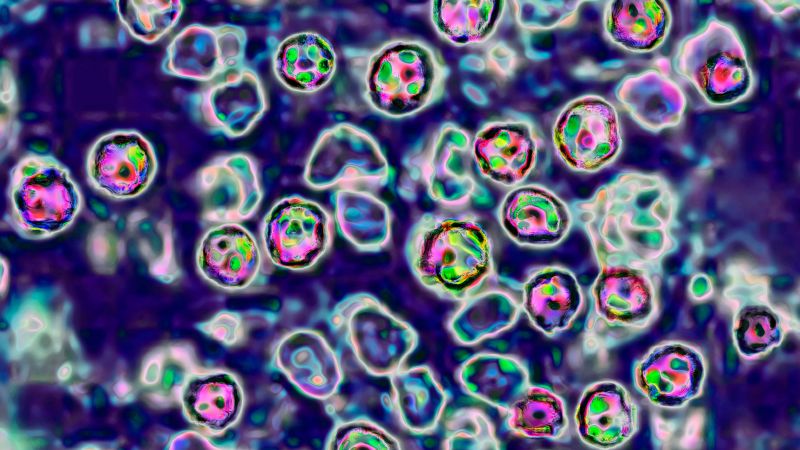 One of two measles-related deaths of unvaccinated people in Pennsylvania was an infant